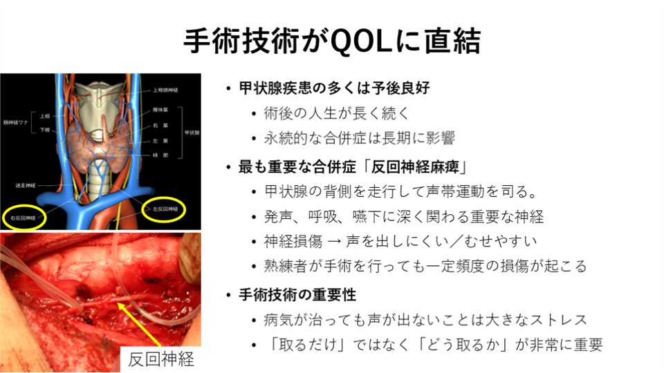 演講投影片「手術技術がQOLに直結」：左側是甲狀腺與喉返神經的解剖圖與術中照片，右側條列甲狀腺疾病預後良好、反回神經麻痺是最重要的併發症，以及手術技術的重要性