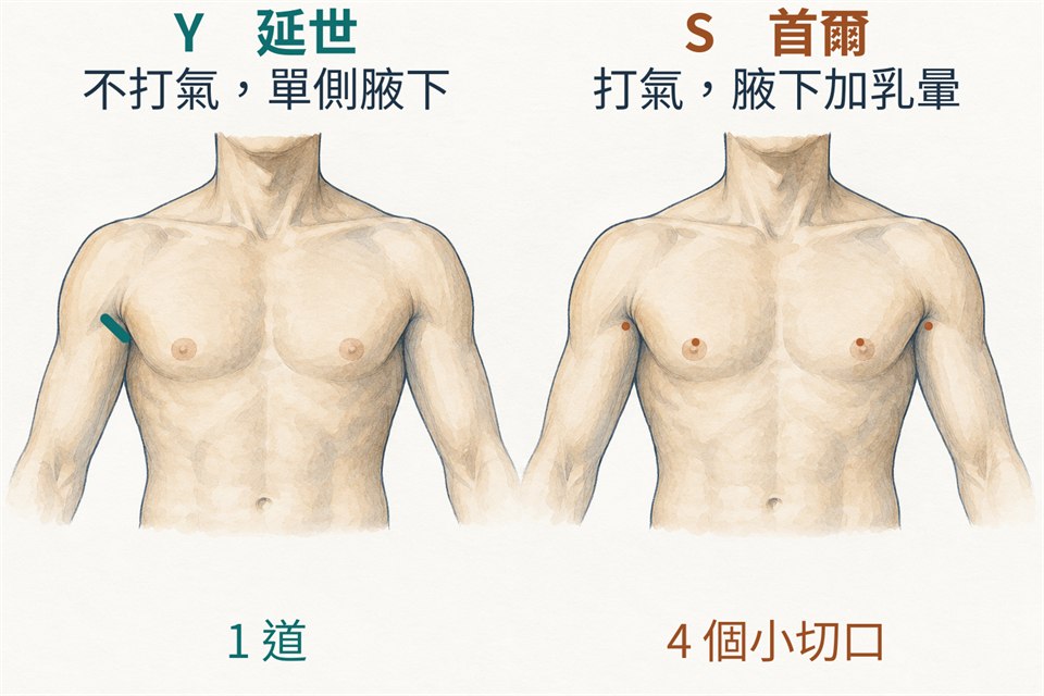 兩個上半身正面的示意圖並列。左邊標「Y 延世／不打氣，單側腋下」，單側腋下有一道藍綠色的切口，下方寫「1 道」。右邊標「S 首爾／打氣，腋下加乳暈」，兩側腋下與兩側乳暈上緣共四個赭色小圓點，下方寫「4 個小切口」