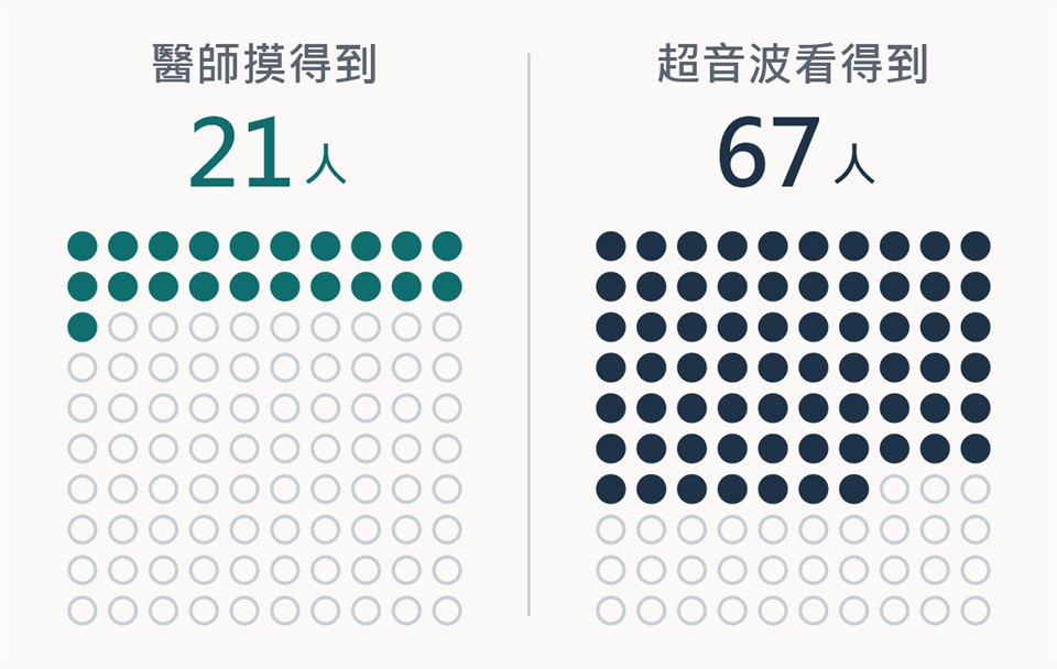 兩組各 100 個圓點的對照圖。左邊標題「醫師摸得到」，大字 21 人，塗滿 21 個圓點；右邊標題「超音波看得到」，大字 67 人，塗滿 67 個圓點