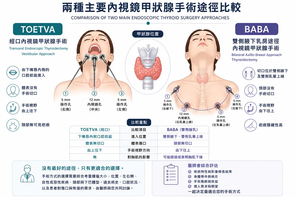 TOETVA 與 BABA 手術途徑比較示意圖。兩種途徑的進入位置、體表傷口與手術視野方向，與本節文字說明相同。